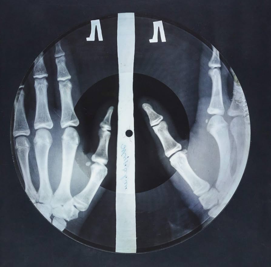 AROUND THE WORLD: Jazz on Russian bones – How and why discarded x-rays were used to sneak forbidden music behind the iron&nbsp;curtain